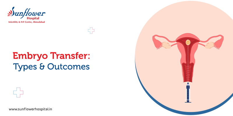 An Introduction to the Types of Embryo Transfer 