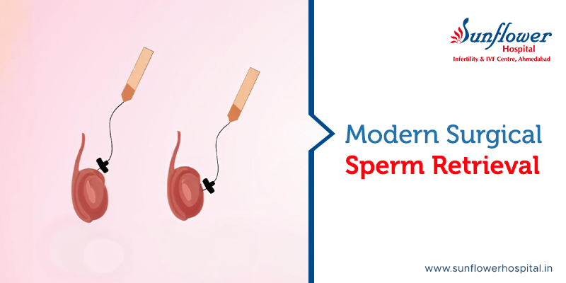 Everything You Need to Know About Surgical Sperm Retrieval Procedures