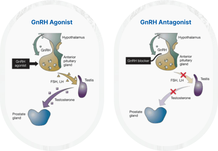 GnRH Agonist and Antagonist