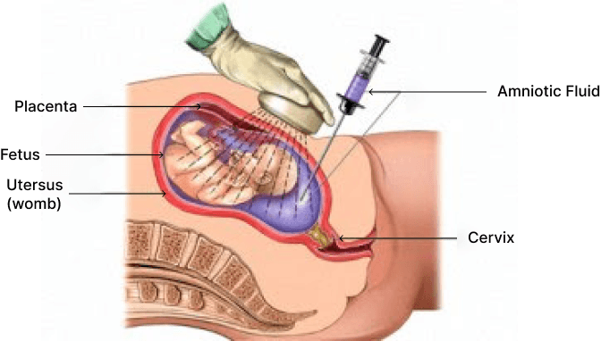 Interventional USG
