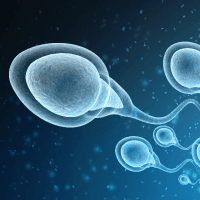 Sperm Retrieval