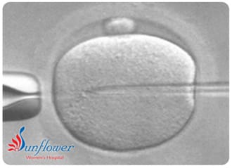 Sperm injection during ICSI