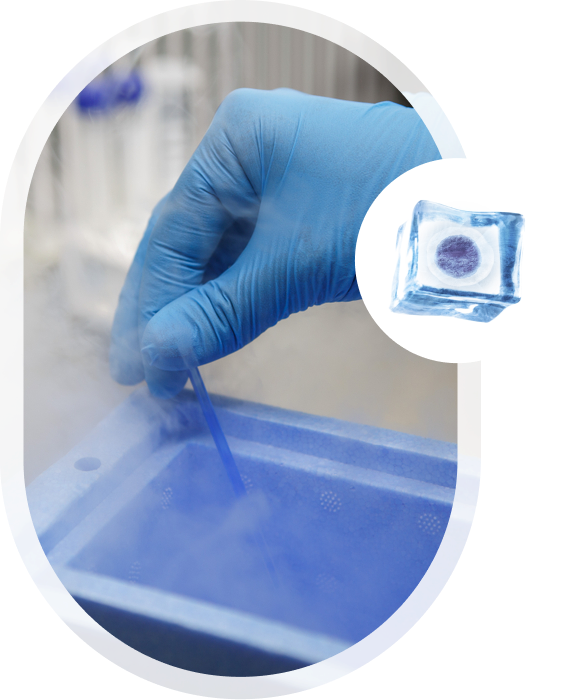 Oocyte Freezing
