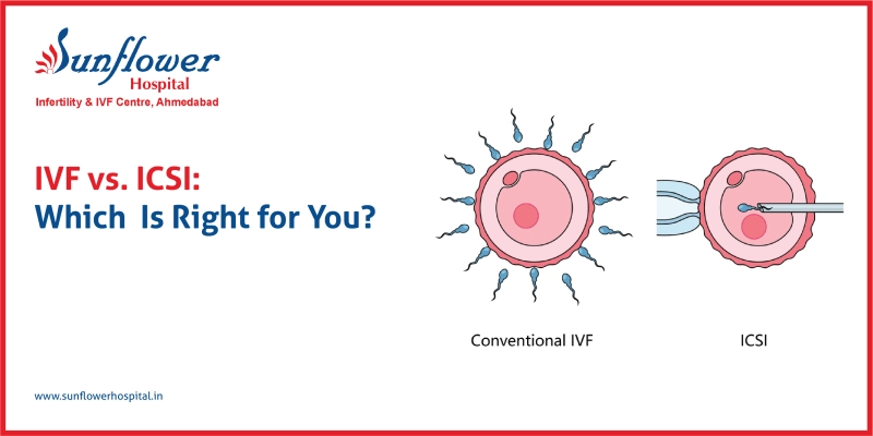 IVF vs ICSI