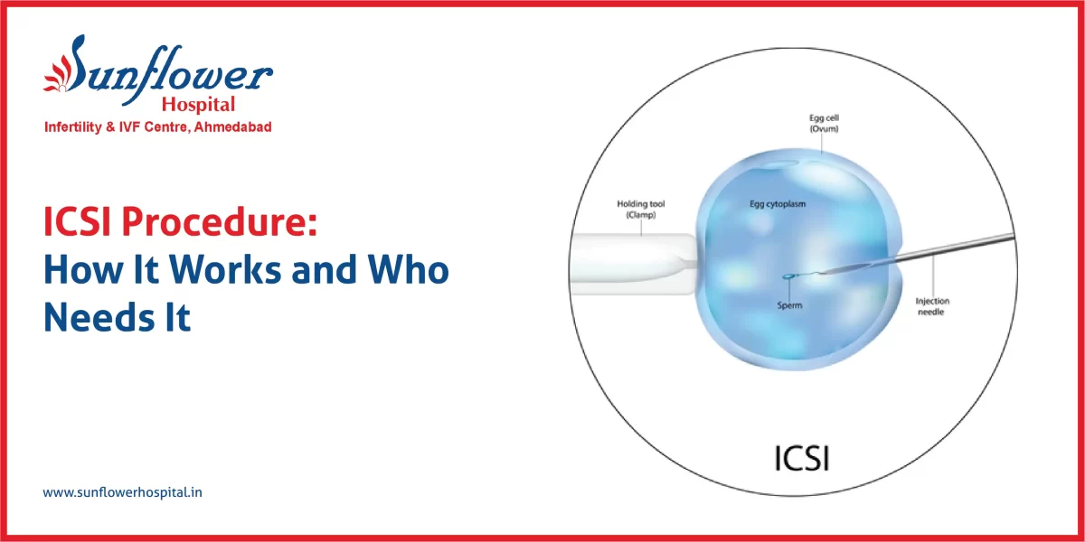 ICSI