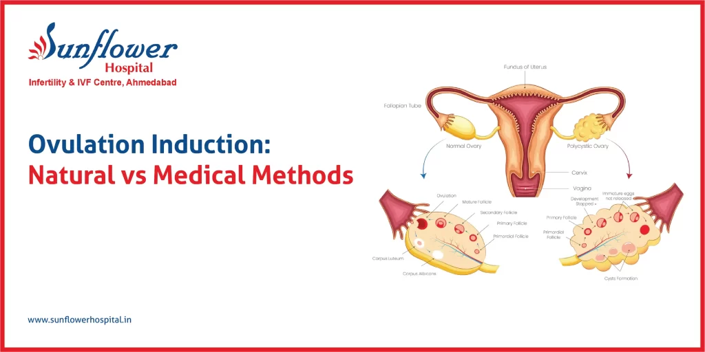 Ovulation Induction