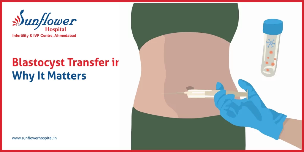 Blastocyst Transfer in IVF