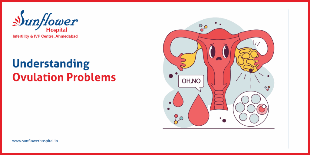 Understanding Ovulation Problems