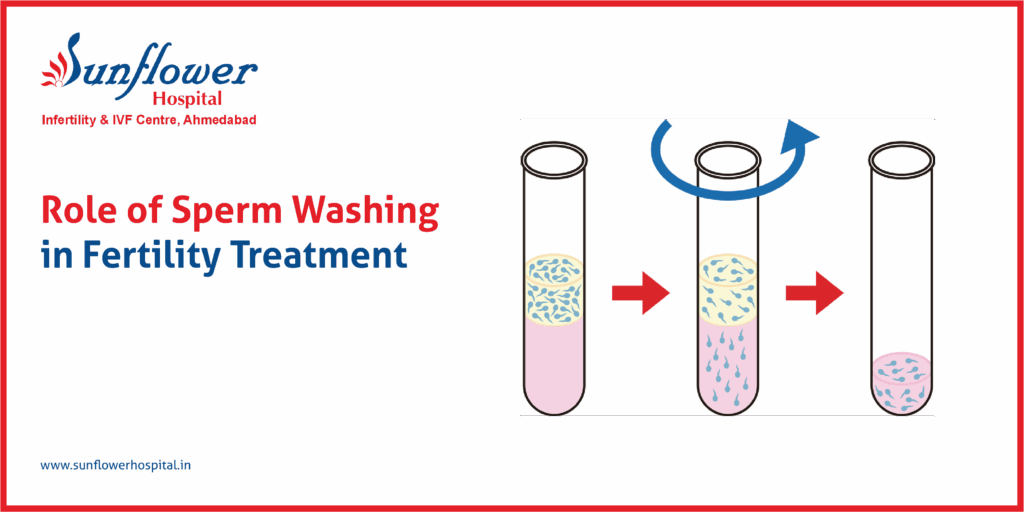 Role of Sperm Washing in Fertility Treatment