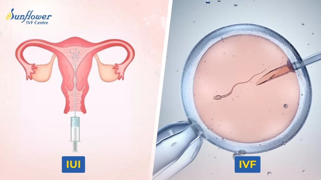IUI vs IVF Treatment: Differences in Process, Cost and Treatment Time